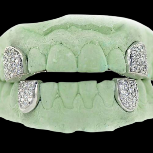 Diamond VS Honeycomb Fangs Only Grillz