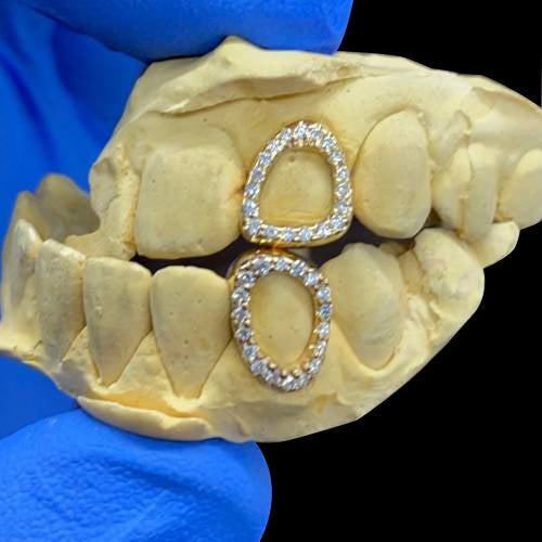 18K VVS Diamond Window Grillz