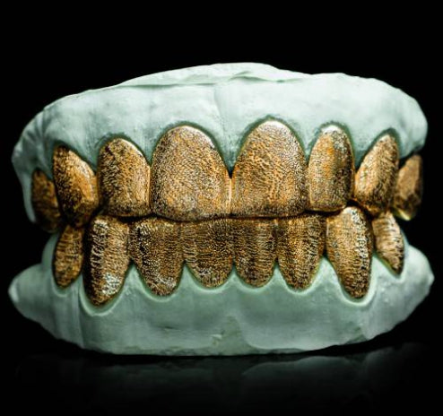 14K Diamond Dusted Solid Textured Grillz